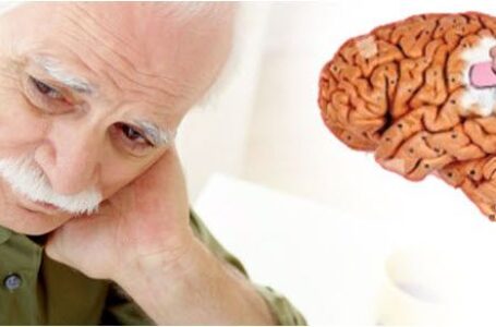 Во САД одобрен лек за Алцхајмеровата болест